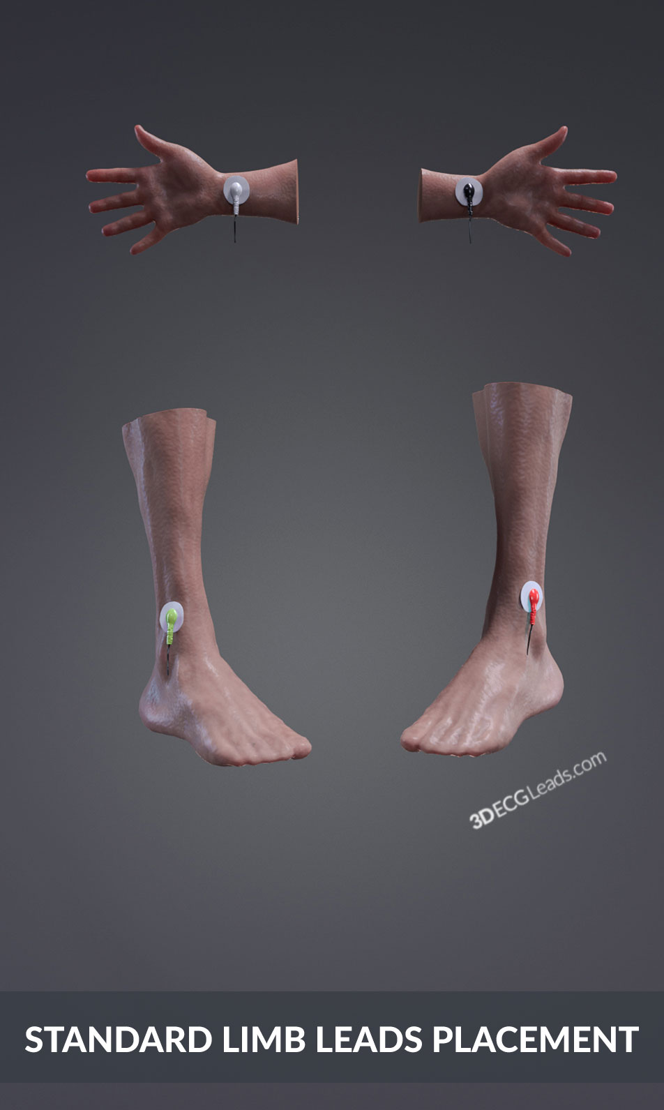 how to place ecg limb leads